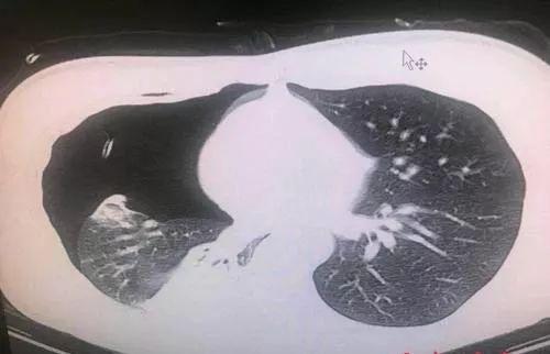 三年前 《生死偷袭》玩家为了抵制游戏官方而坚守142号房间_BJL平台(图2) BJL平台